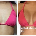 Domowe sposoby na powiększenie biustu bez operacji ovashape