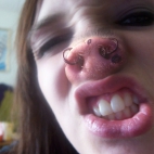 świnski nos