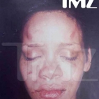 Rihanna -- The Face of a Battered Woman
