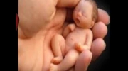 Płacz nienarodzonego dziecka - Stop Aborcji !